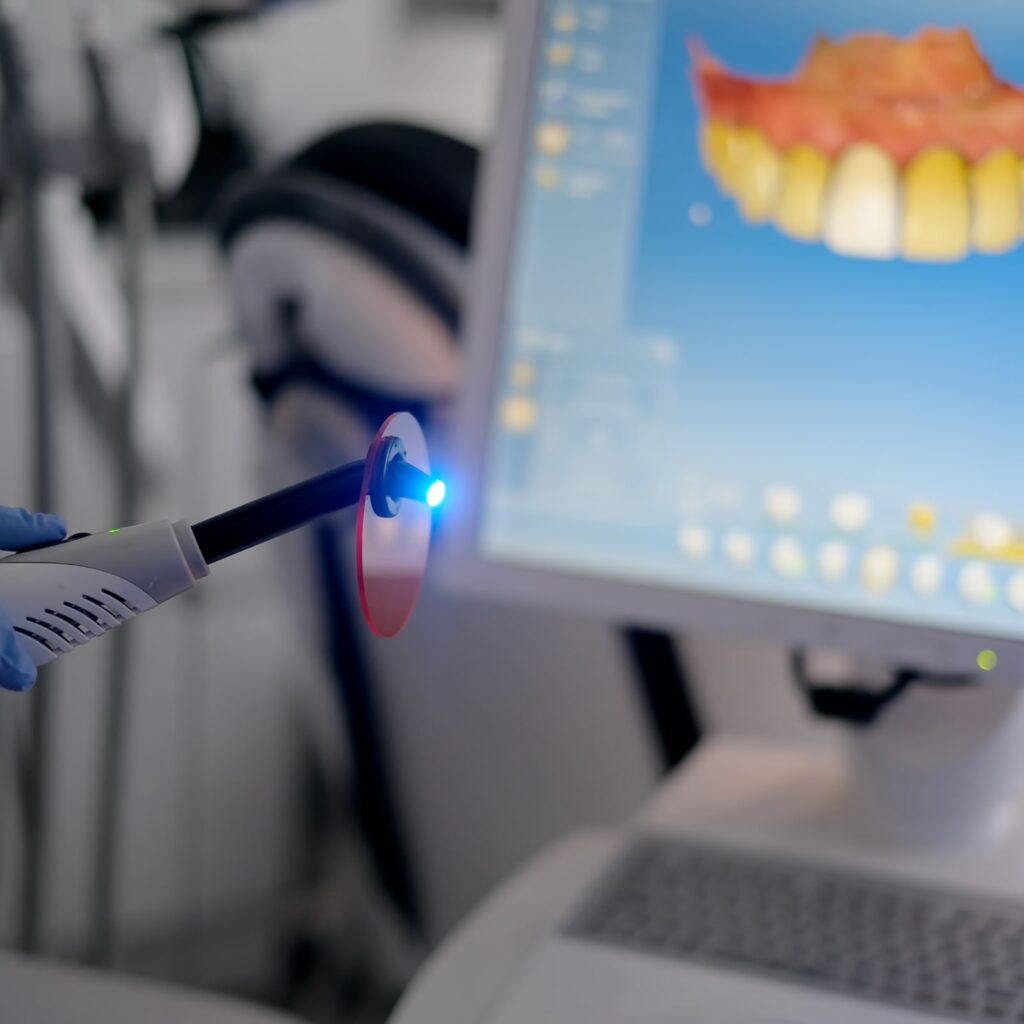 Dental curing UV light on Cerec Monitor